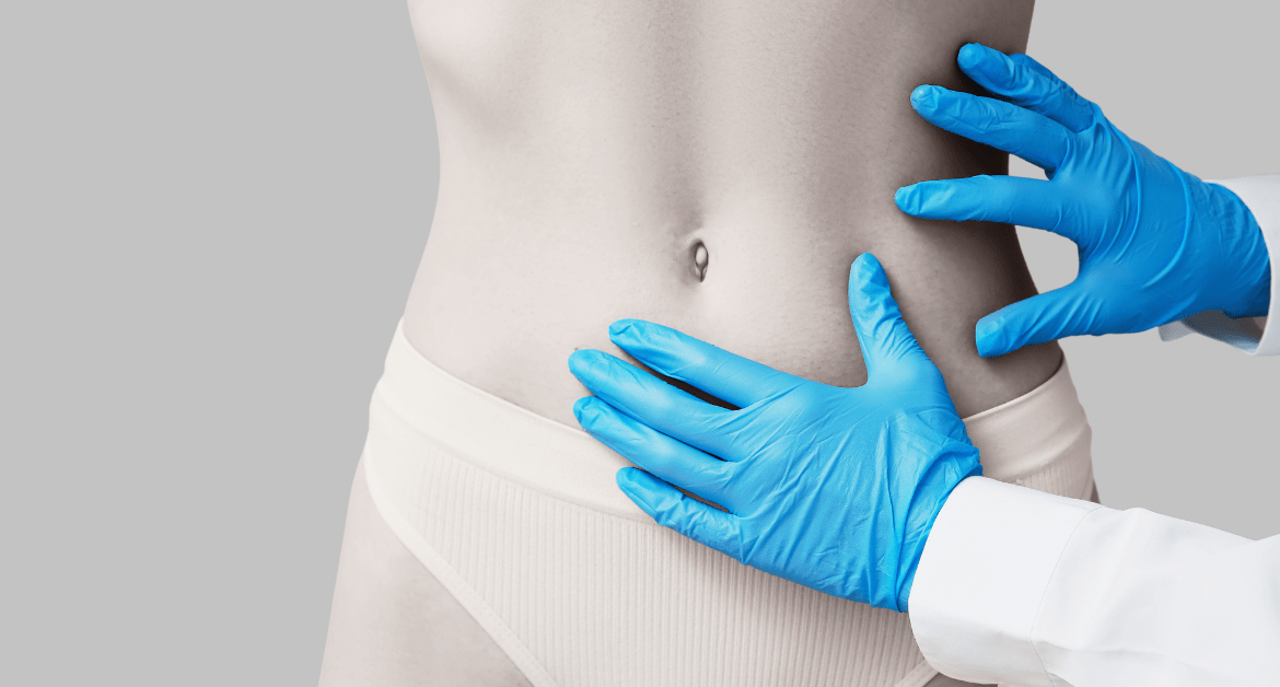 Fettsugning vs. bukplastik